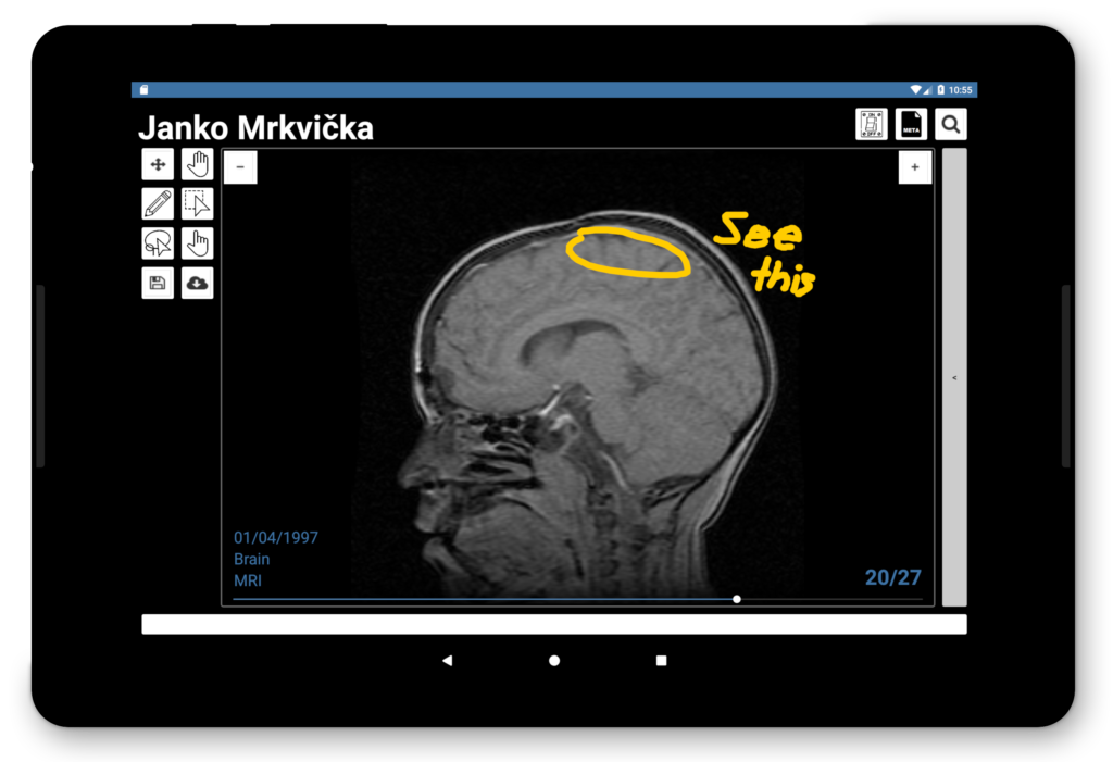 MedPix: Zjednodušenie analýzy medicínskych obrazových dát 4